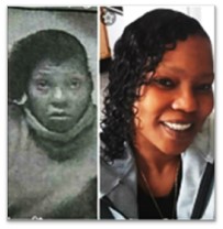 Trina before and after picture